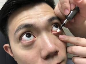 Microblepharoexfoliation is an adjunctive therapy for blepharitis